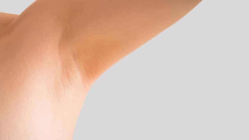 Fach­ärztliche Schweiß­be­handlungen (Hyper­hidrose)